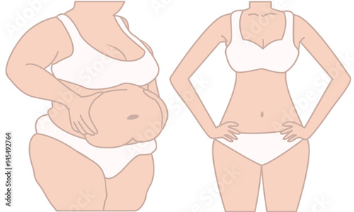 Woman before and after diet weigh loss. Fat and slim woman. Women pinch the stomach. Women weight loss success. 