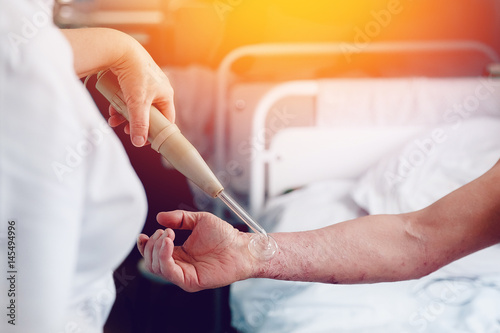 doctor with the phone treats a patient with a skin disease using the Darsonval apparatus for the treatment of dermatitis, apathic, seborrhea, eczema. photo