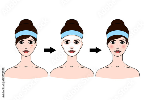 Step-by-step use of facial masks from acne.