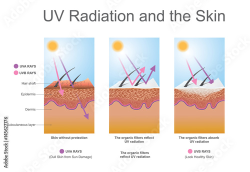 UV radiation and the skin.
Effects the elastin in the skin and leads to wrinkles. Vector graphic, Illustration.