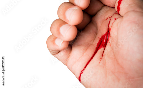 Vászonkép Hand of man injured wound from accident and blood bleeding on white background ,