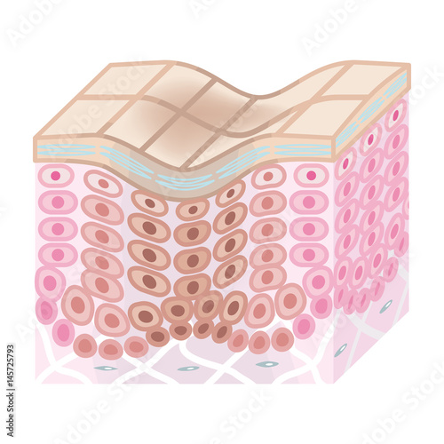 Skin Cross Section -Bad condition　
肌の断面図　老化
