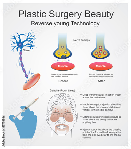 Plastic surgery beauty. Graphic Vector.