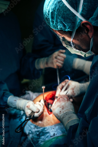 Team of Surgeons Operating.