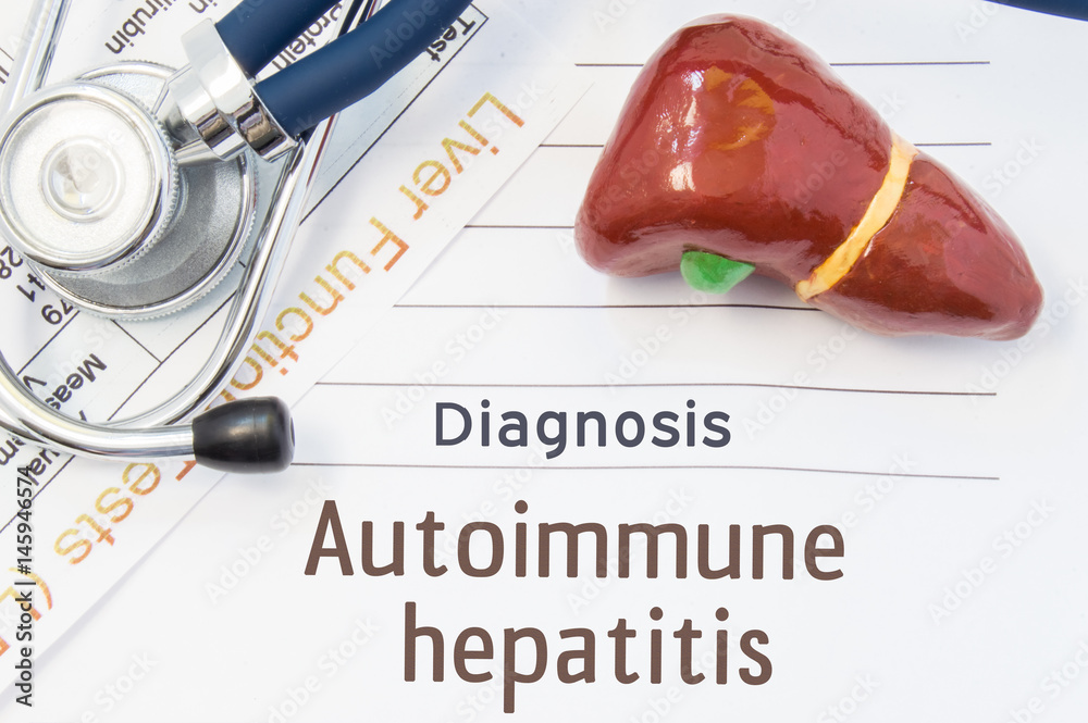 Autoimmune hepatitis diagnosis. Anatomical 3D model of human liver is