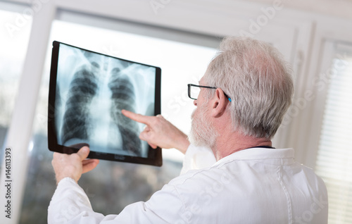 Doctor looking at x-ray