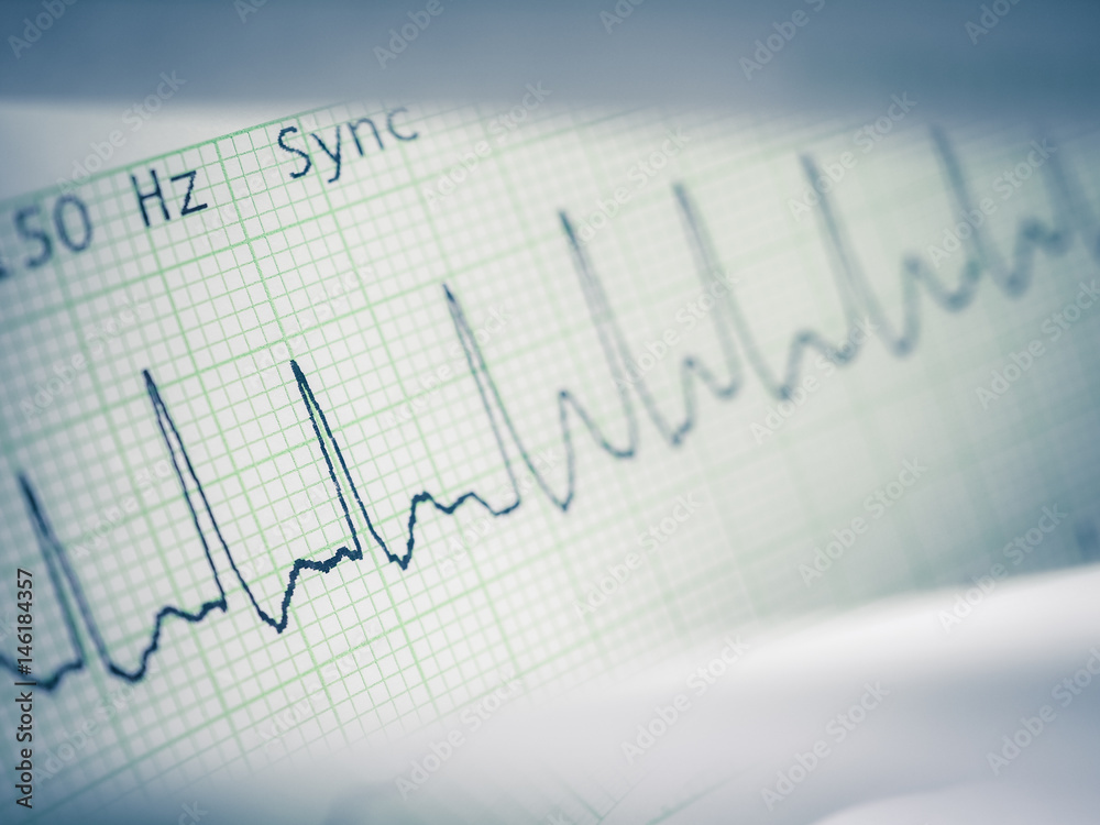 heart breath graph report for medical education and health care heart breath graph report for medical education and health care