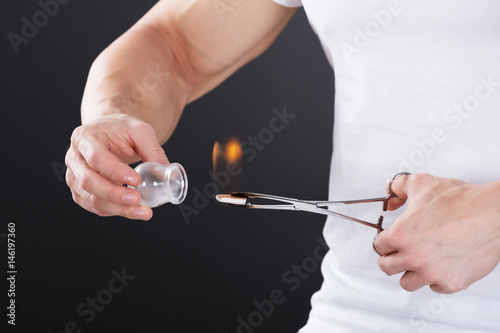 Wallpaper Mural Therapist Giving Cupping Therapy Torontodigital.ca