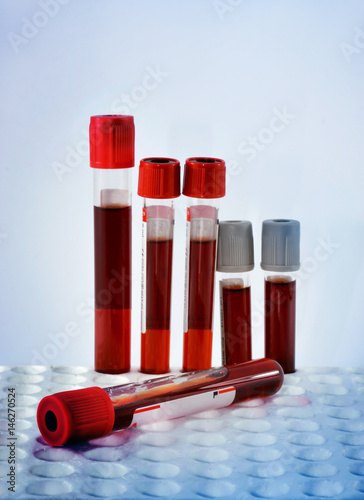 Tubes blood sample in rack.(blue tone).