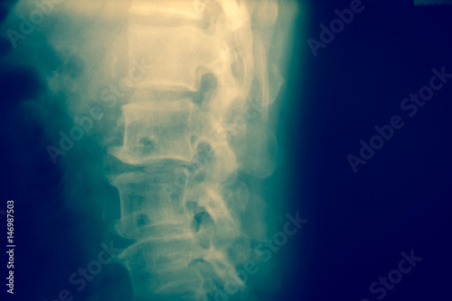 Foto Close up spinal cord bone