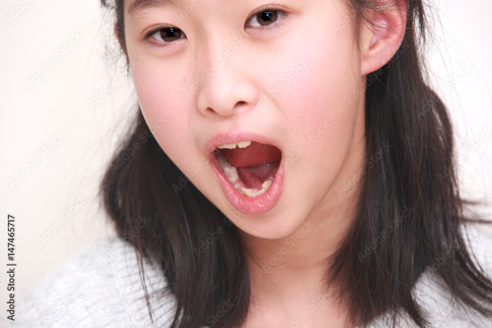 小学生　口 大きく口を開ける女の子｜小学生の女の子ポートレート Stock 写真 | Adobe Stock