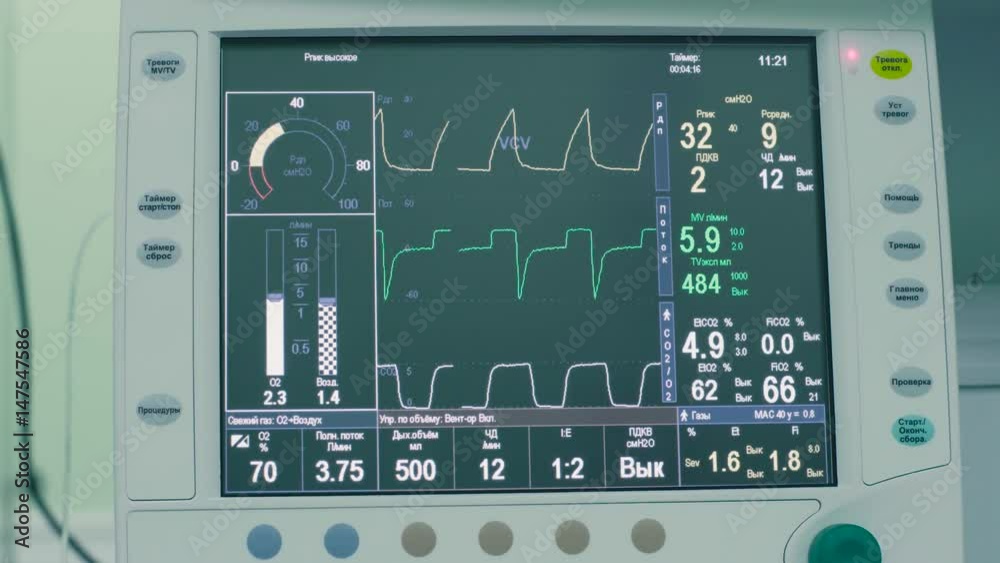 The monitor a patient in the operating room The monitor a patient in the operating room