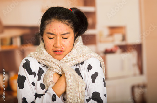 Canvas Print Portrait of young girl with skin problem with a wool sweater around his neck