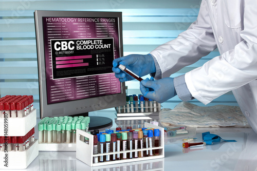 Photos Technician in lab examining blood sample with screen CBC Complete Blood Count in
