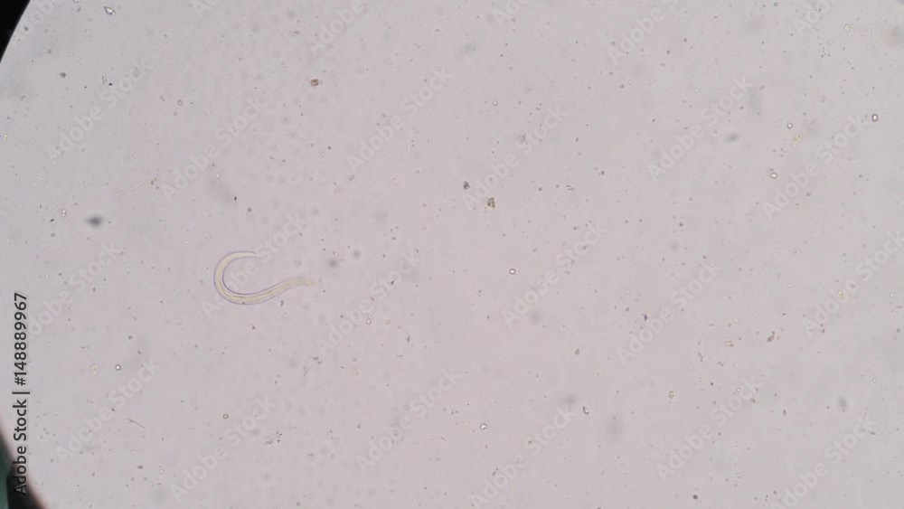 Moment of Strongyloides stercoralis (threadworm) in stool, analyze by ...