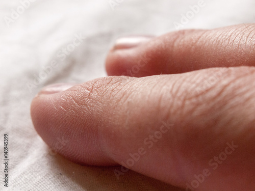 two human fingers close up with cracked detailed skin