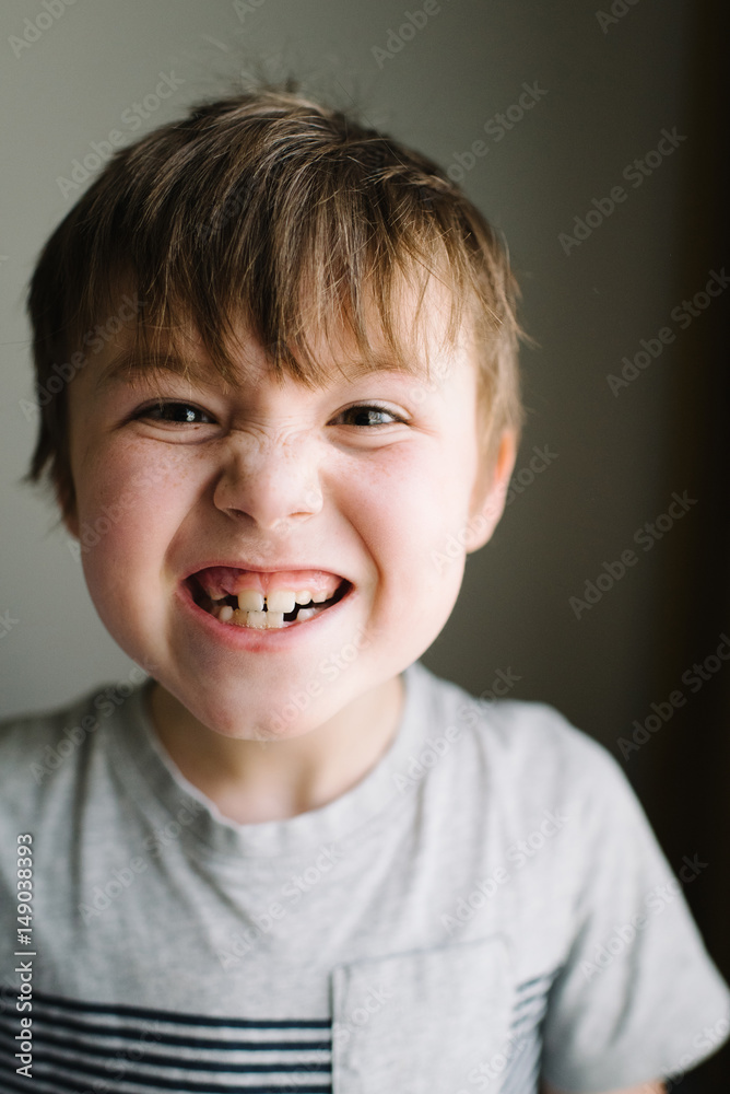 Boy making a face Boy making a face