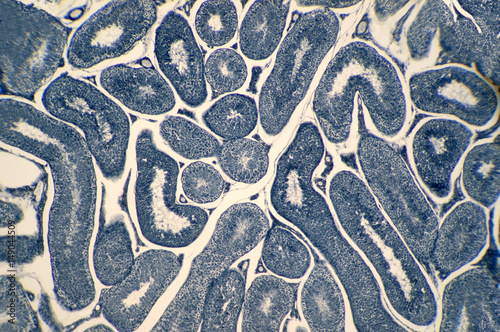 Cross section Human testis under microscope view. photo