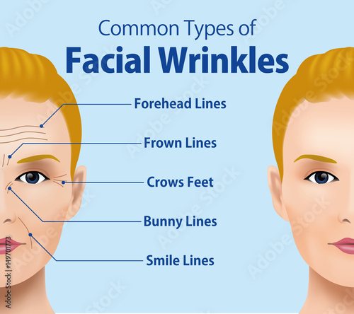 Common Types of Facial Wrinkles. cosmetic surgery. woman facial treatment concept.