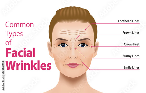 Common Types of Facial Wrinkles. cosmetic surgery. woman facial treatment concept.