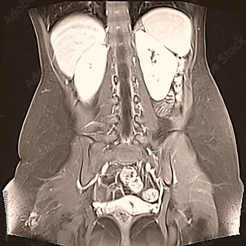 Contrast radiography of the gastrointestinal tract
