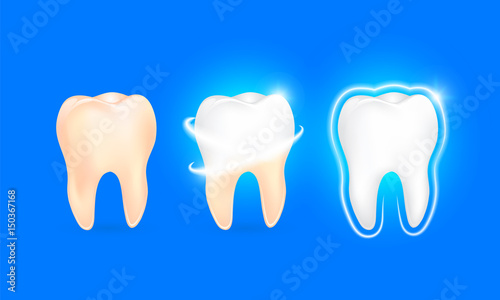 Set of  clean and dirty tooth on blue background, clearing tooth process. Teeth Whitening. Dental health Concept. Oral Care, teeth restoration. Yellow and white teeth.