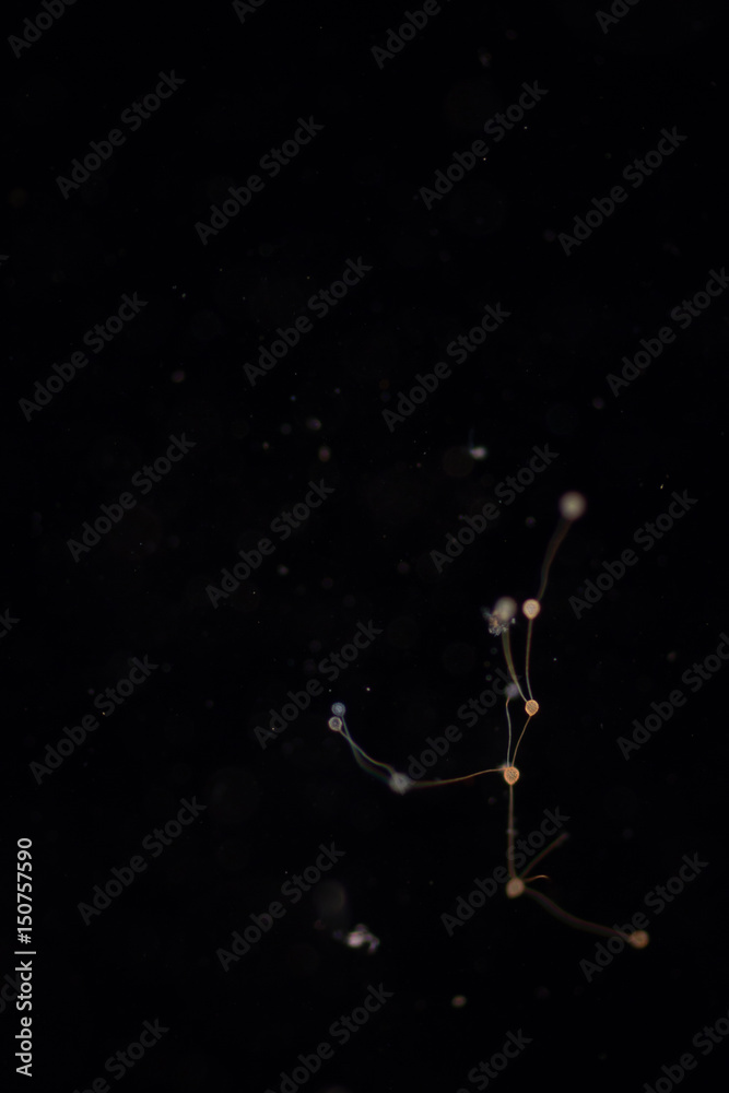 Clathrulina elegans (Protozoa) under the microscope. Clathrulina elegans (Protozoa) under the microscope.