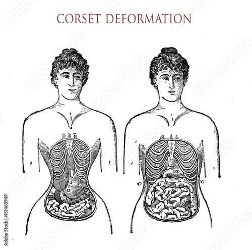 Obraz na plátně Vintage fashion lifestyle, corset usage and unhealthy deformation