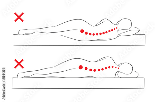The incorrect spine alignment when sleeping by on the side sleeping position.