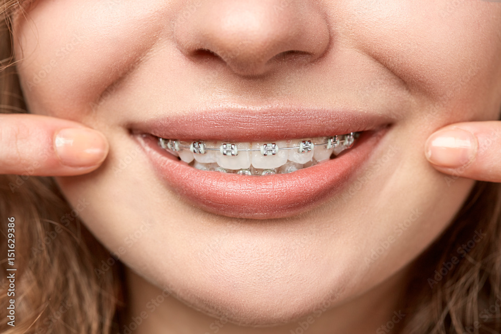 curly hair woman with brackets curly hair woman with brackets