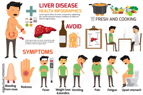 liver disease vector infographics. Sign and symptoms of liver disease. vector illustration.