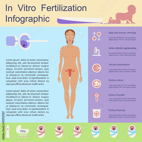 In vitro fertilization infographic. Illustration showing egg retrieval procedure, fertilization in laboratory, fertilized egg development and embryos transfer back to the uterus. Vector conceiving