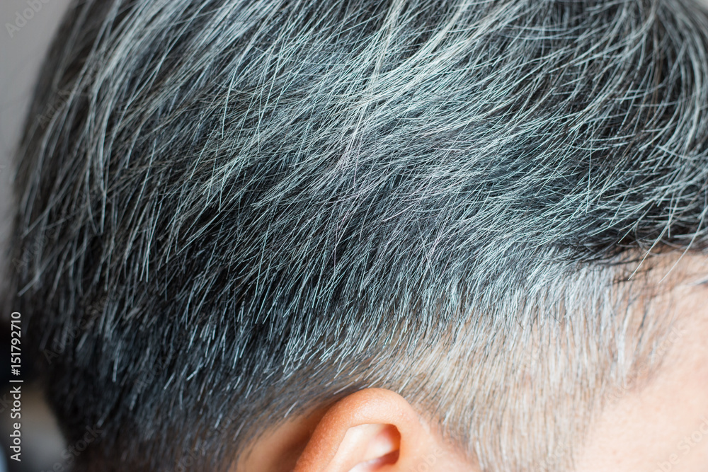Going gray in young man shows his gray hair, hair getting grey and balding  Stock Photo | Adobe Stock
