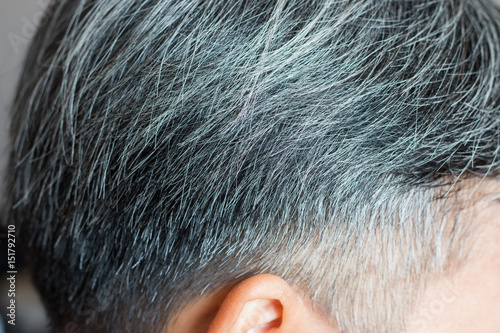 Going gray in young man shows his gray hair, hair getting grey and balding photo