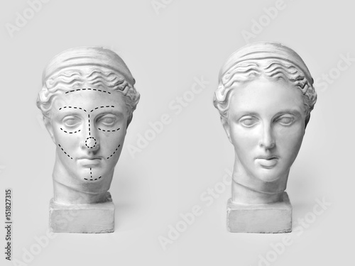 Two marble heads of young women, ancient Greek goddess bust marked with lines for plastic surgery and sculpture after operation on light background. Old and new beauty standarts concept.