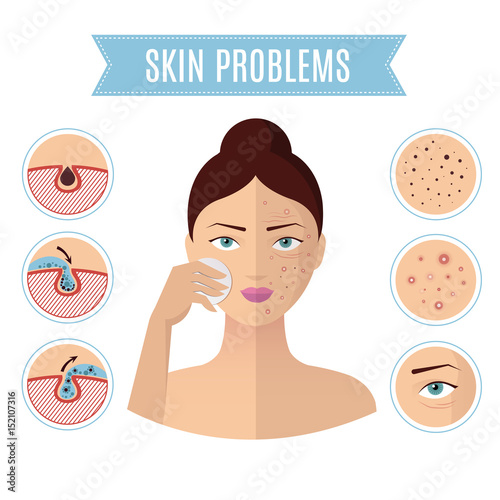 Skin problem solving, acne treatment and cleansing pore for perfect womans face vector icons