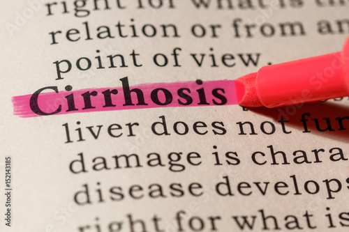 definition of cirrhosis photo
