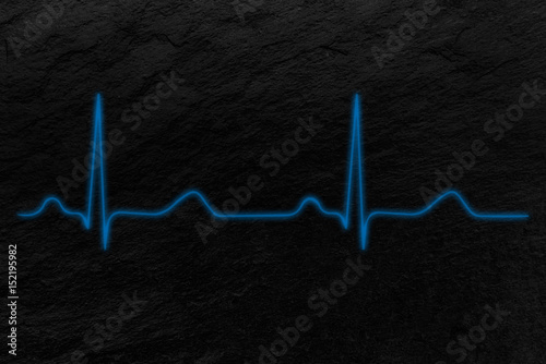 Electrocardiograma photo