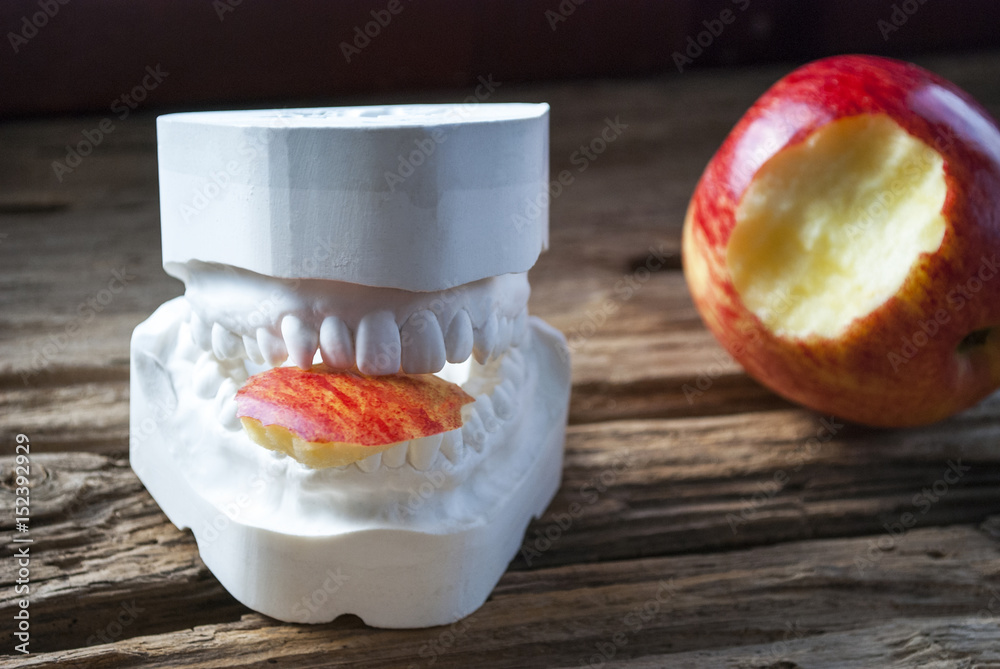 Gebiss Abdruck mit Apfel, gesunde Ernährung, Zahnvorsorge Stock-Foto ...