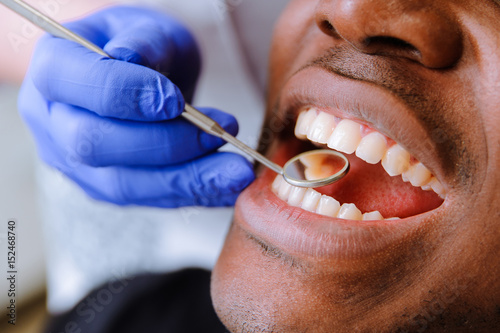 Fototapet African male patient getting dental treatment in dental clinic