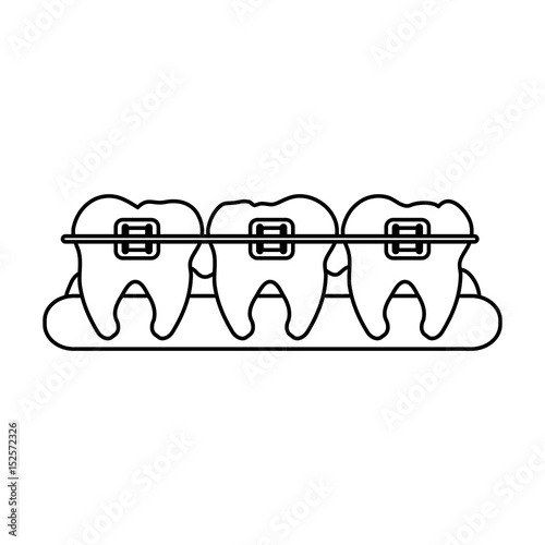 molars with braces dental care related icon image vector illustration design 