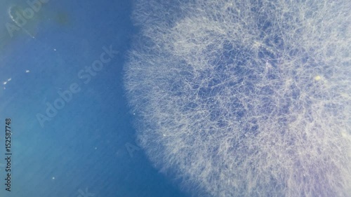 Growing mushrooms in a petri dish, Growth Colony Of Microbes And Pathogenic Fungi In Petri Dish