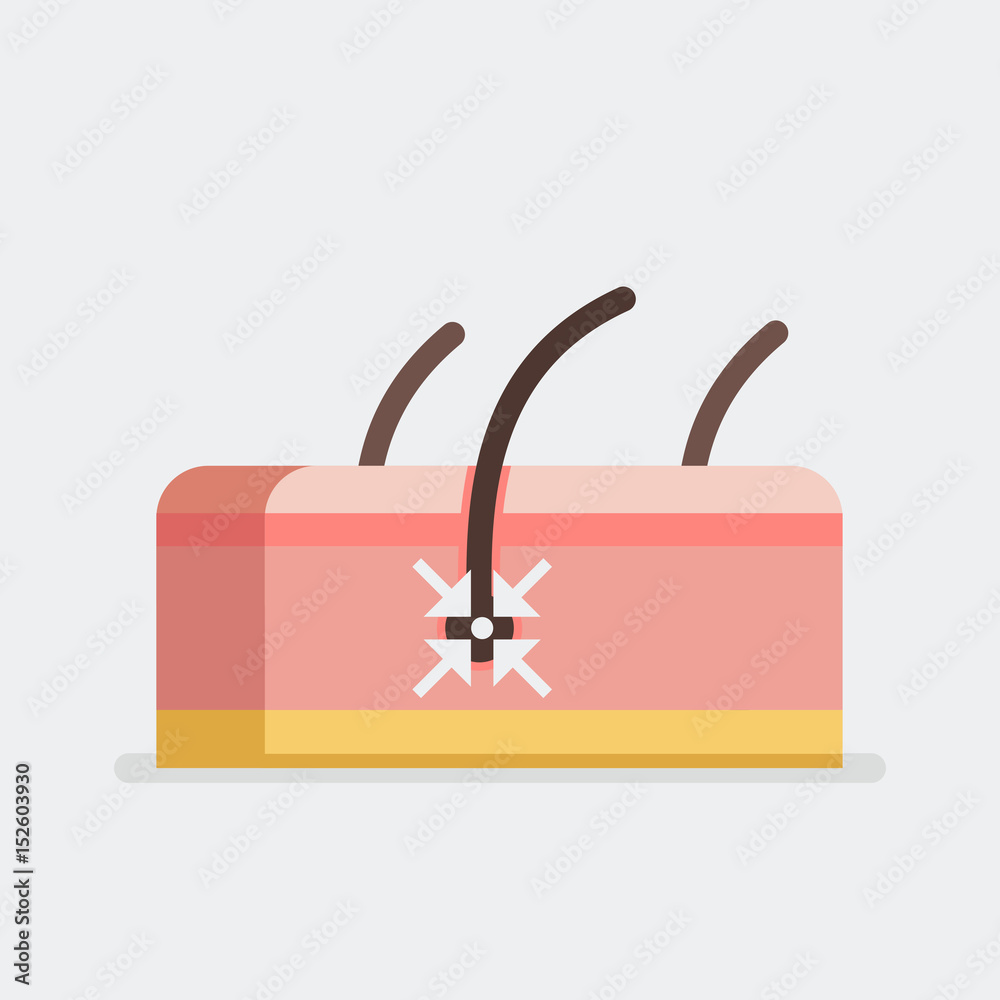 Skin vector illustration Skin vector illustration