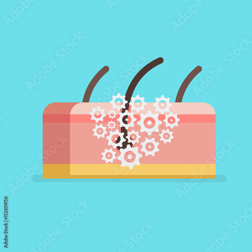 Skin vector illustration