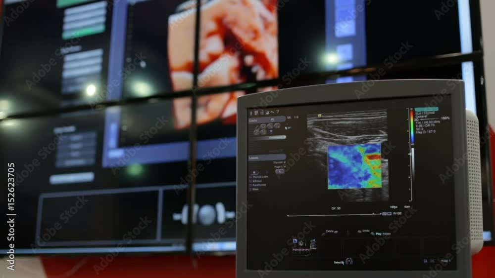 Ultrasonography of human organs Ultrasonography of human organs