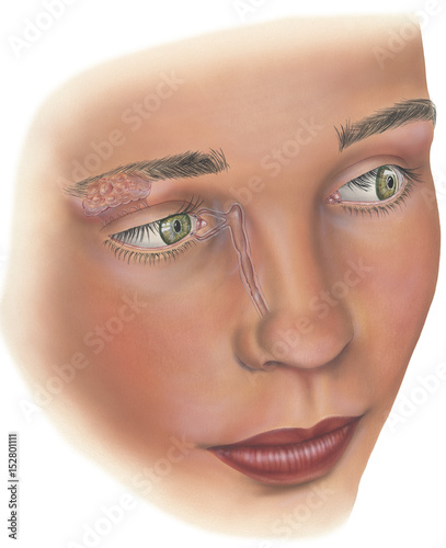 Human Eye Irrigation system. Shown are the lacrimal gland, lacrimal duct, lacrimal puncta, lacrimal canaliculus, nasolacrimal duct, cornes, pupil and iris photo