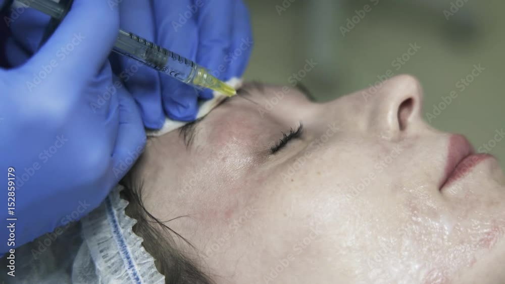 Close up of a cosmetician doing shots in woman s eyelid and wiping blood with a cotton pad. Handheld real time close up shot Close up of a cosmetician doing shots in woman s eyelid and wiping blood with a cotton pad. Handheld real time close up shot