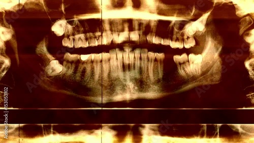 X Ray Glitch