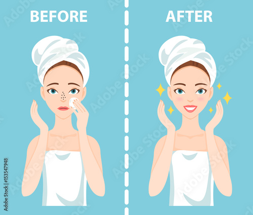 Before-After set of upset troubled and happy woman with female facial skin problems needs to care about: blackheads, clogged nose pores.