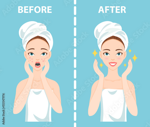 Before-After set of upset troubled and happy woman with female facial skin problems needs to care about: acne, pimples.